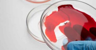 Excès de fer dans le sang : les aliments à privilégier et ceux à éviter absolument