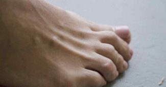 Champignons aux ongles des pieds : l’eau de Javel est-elle vraiment un bon traitement ?