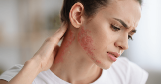 Eczéma cou : comment venir à bout des plaques rouges qui démangent.