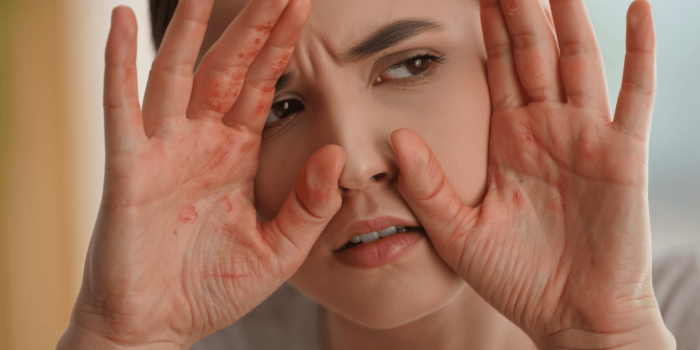 Quelles sont les causes des démangeaisons des mains et comment les soulager rapidement ?