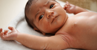 Peau sèche bébé : tout comprendre pour le soulager et protéger sa peau