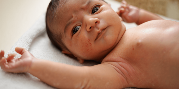 Peau sèche bébé : tout comprendre pour le soulager et protéger sa peau