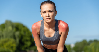 Eczéma et transpiration : quel sport choisir et quelles précautions pour éviter les crises ?