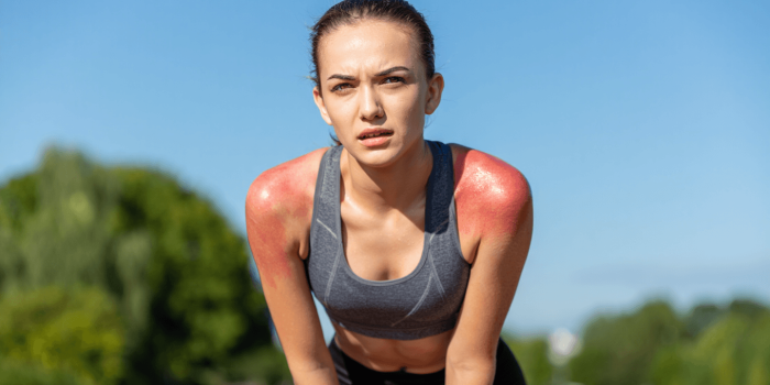 Eczéma et transpiration : quel sport choisir et quelles précautions pour éviter les crises ?
