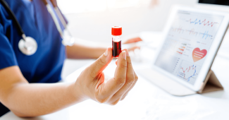 Cholestérol LDL : élevé, normal et solutions pour le faire baisser