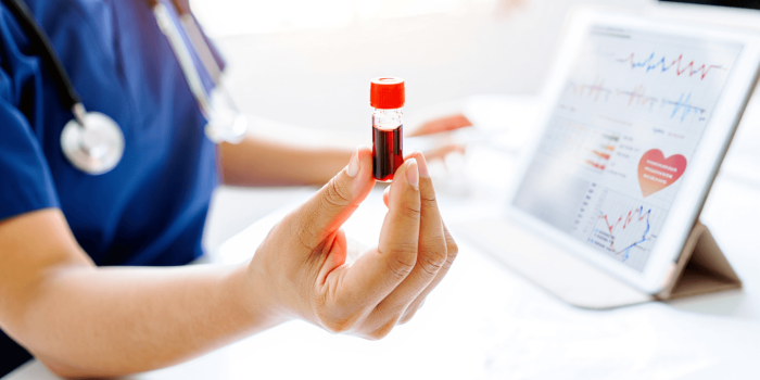 Cholestérol LDL : élevé, normal et solutions pour le faire baisser