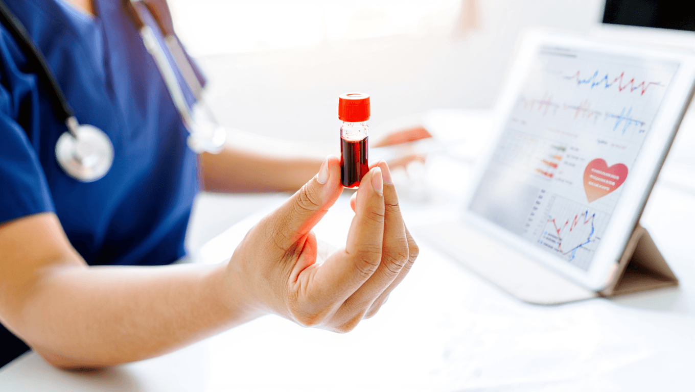 Cholestérol LDL : élevé, normal et solutions pour le faire baisser