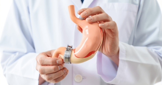Anneau gastrique : fonctionnement, indications et résultats