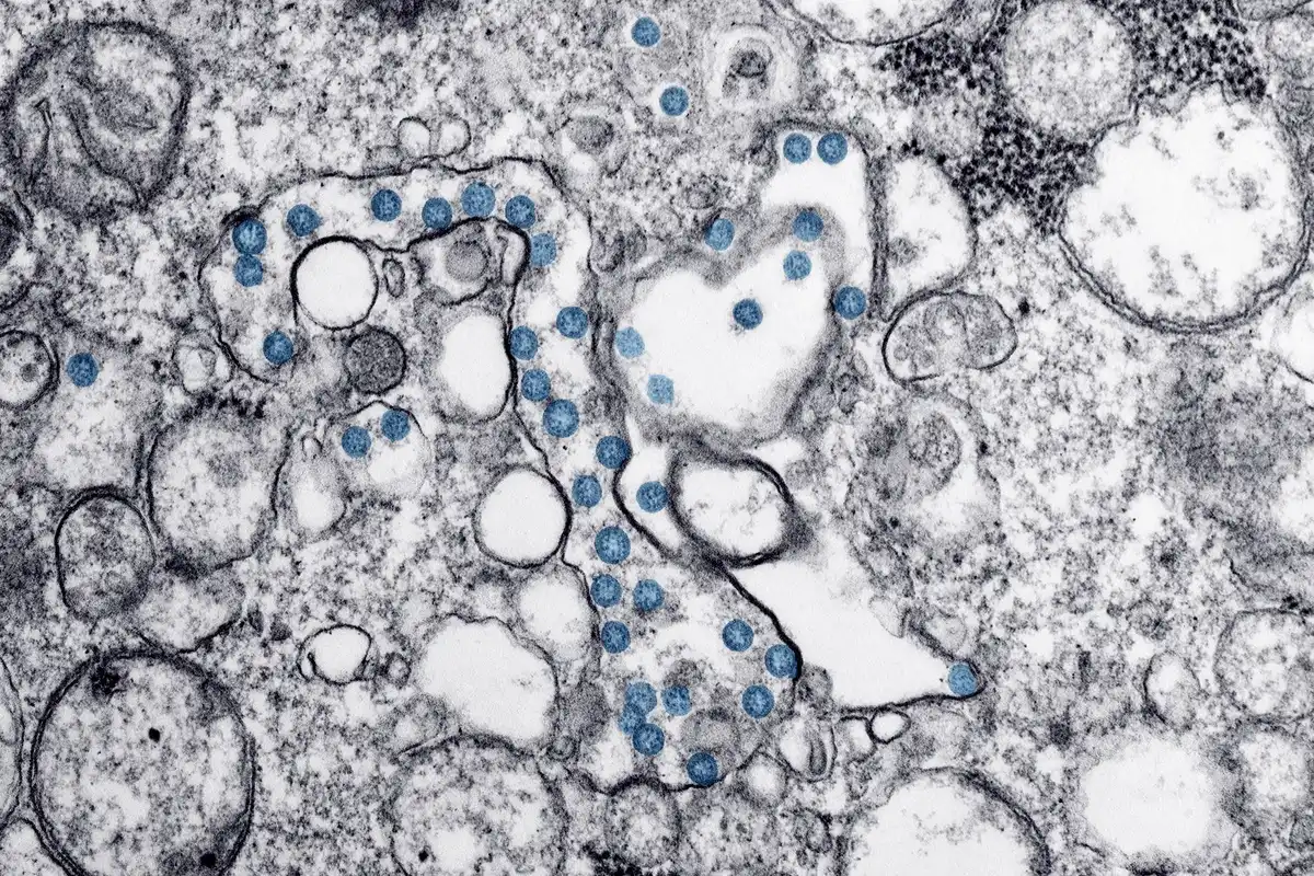 Illustration scientifique de la réponse immunitaire face à une infection virale