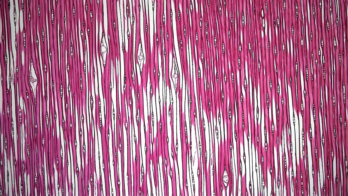 Illustration de la synthèse protéique au niveau cellulaire musculaire