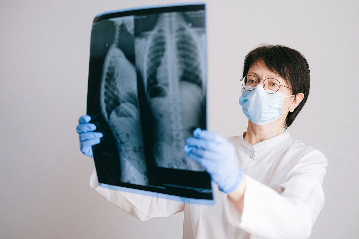 Un professionnel de santé examine une radiographie pulmonaire pour diagnostiquer une infection respiratoire