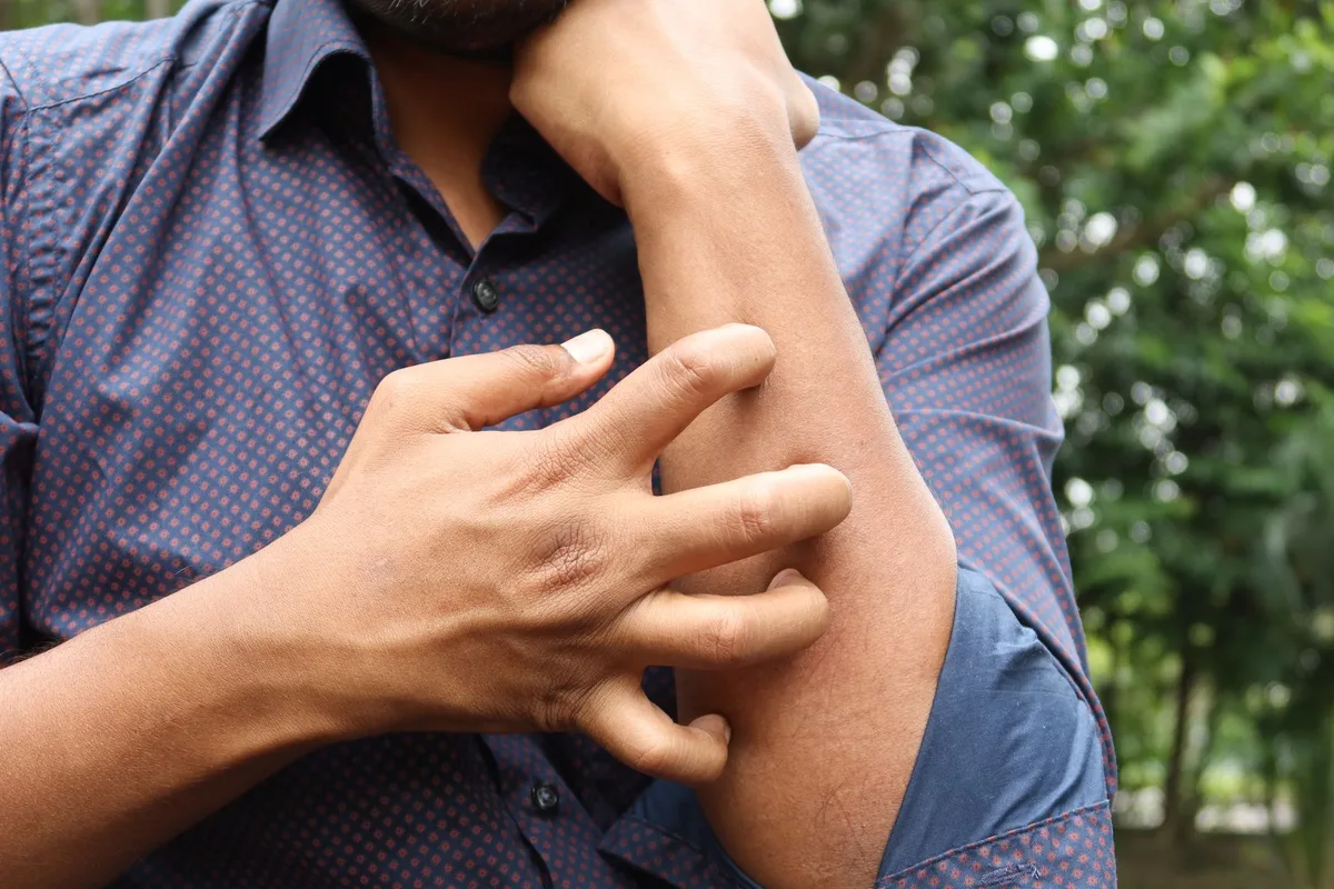 Symptômes allergiques sur la peau : rougeurs, démangeaisons et irritations