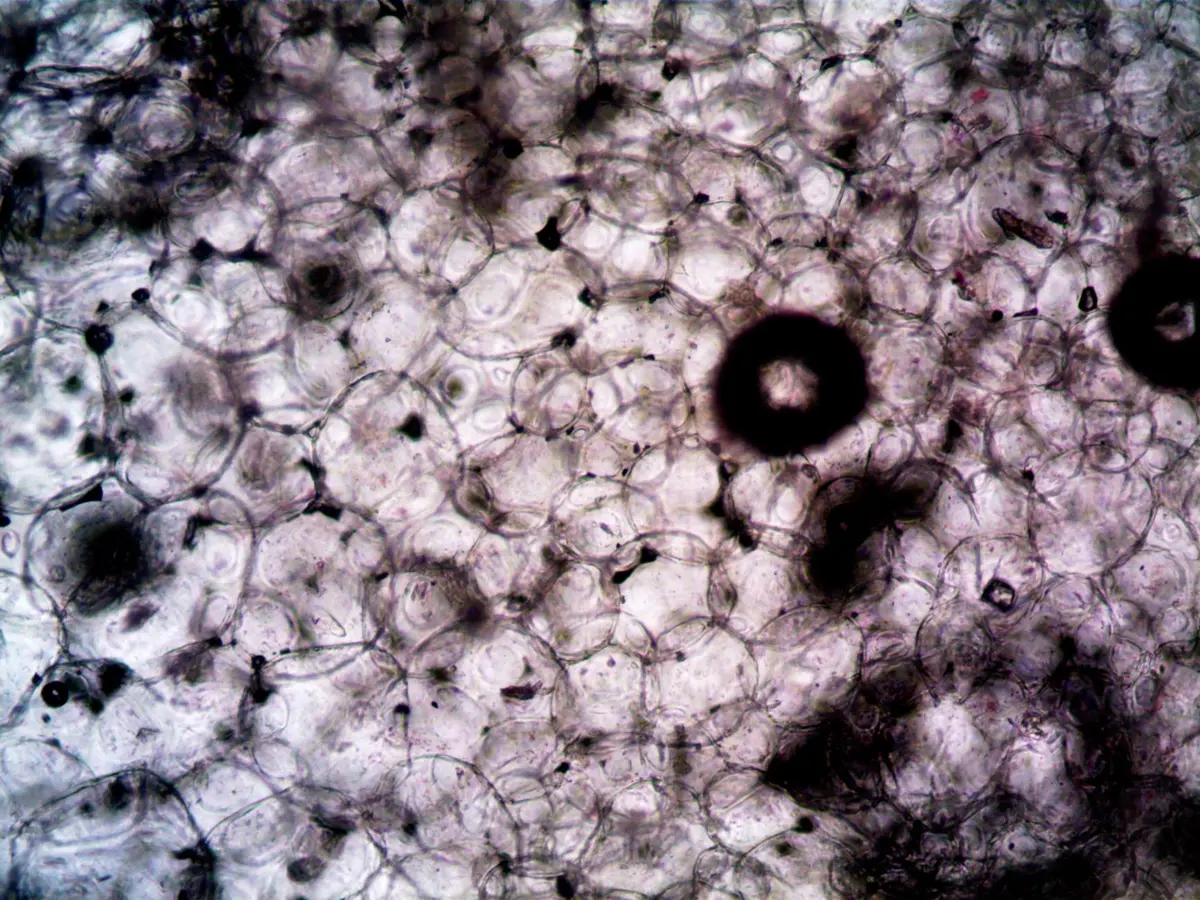 Cellules biologiques observées au microscope pour étudier l'action des anticorps monoclonaux
