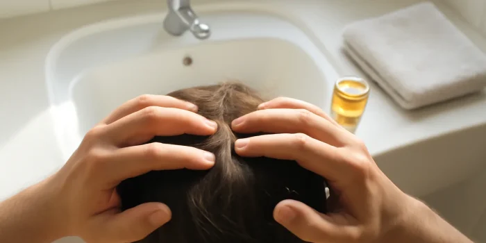 Cuir chevelu qui gratte : causes, symptômes et 10 solutions efficaces